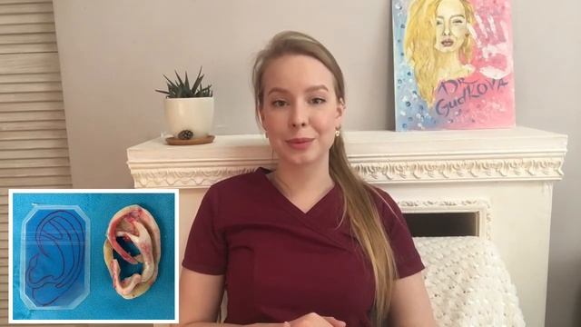 Устранение лопоухости (отопластика). Коррекция ушей