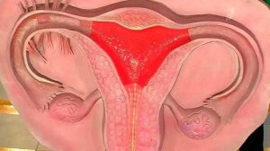 Как избавиться от ужасных месячных. Жить здорово! Фрагмент выпуска от 04.06.2015