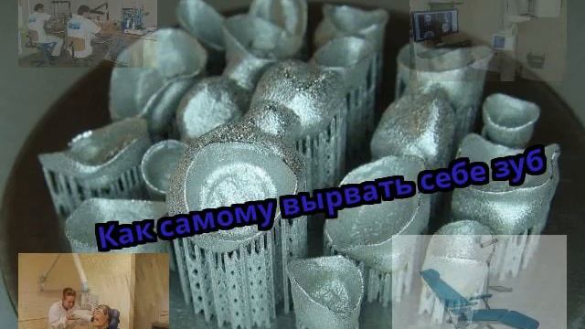 Как самому вырвать себе зуб смотреть онлайн