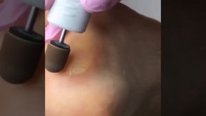 Лукас. Колпачки для аппаратного педикюра