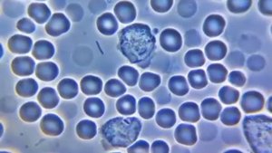 амебоидное движение