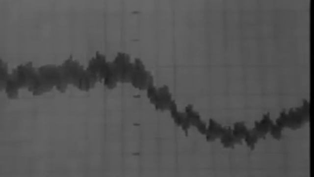 Движение крови по сосудам смотреть онлайн