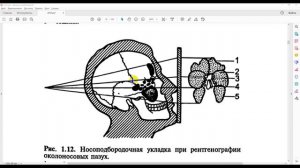 Методы исследования носа и околоносовых пазух