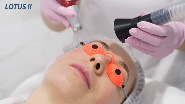 Lotus II - многофункциональная ER:YAG лазерная система (процедура лазерного омоложения) смотреть онлайн