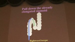 Техника колоноскопии Кашида перевод Галкова