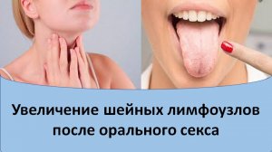 Увеличение шейных лимфоузлов после орального секса