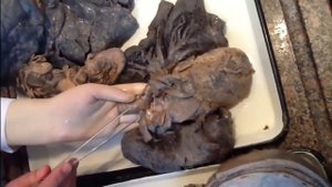 Анатомия органов дыхательной системы. Гортань. Трахея. Бронхи и легкие