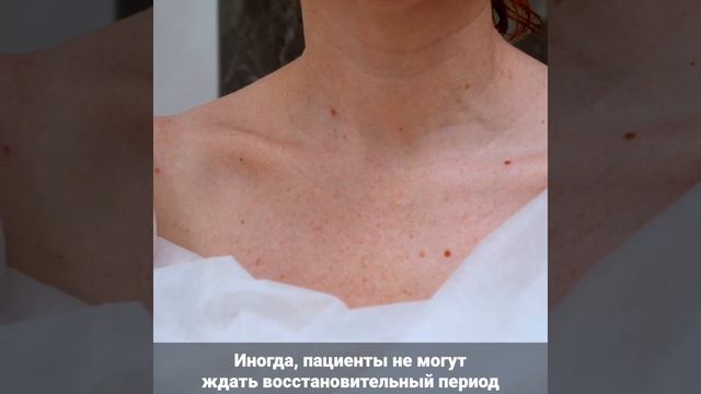 Декольте