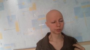 Алопеция - не проблема. Алопеция - это данность.