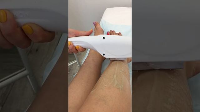 Элос эпиляция в Самаре - CustHair смотреть онлайн