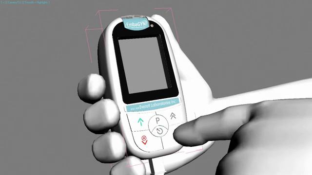 Эмбаджин элетромиостимуляция при недержании мочи и тренировке мышц тазового дна смотреть онлайн