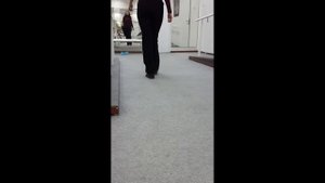 Протез стопы по Шопару