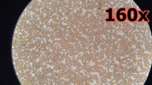 Кровь после мёда