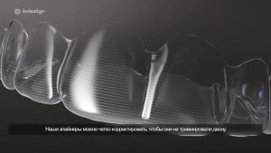 Элайнеры для выравнивания зубов Invisalign в Ставрополе