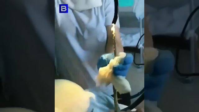 Змея залезла в рот смотреть онлайн