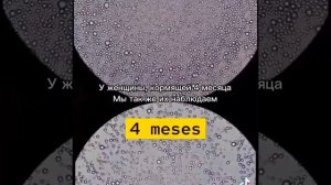 Как выглядит грудное молоко под микроскопом?