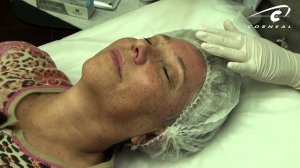 Простые правила микронидлинга