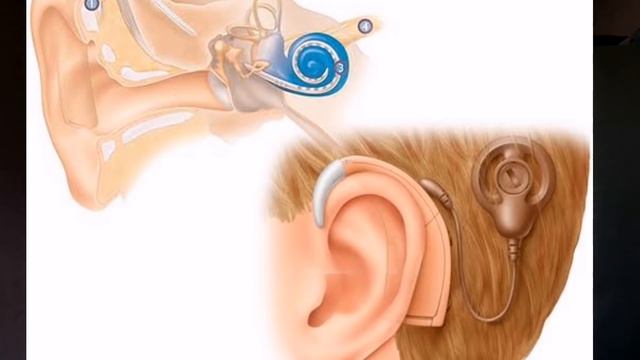 Mri indications, dangers, contraindication, magnetic resonance imaging, bangla, dr Prasenjit datta