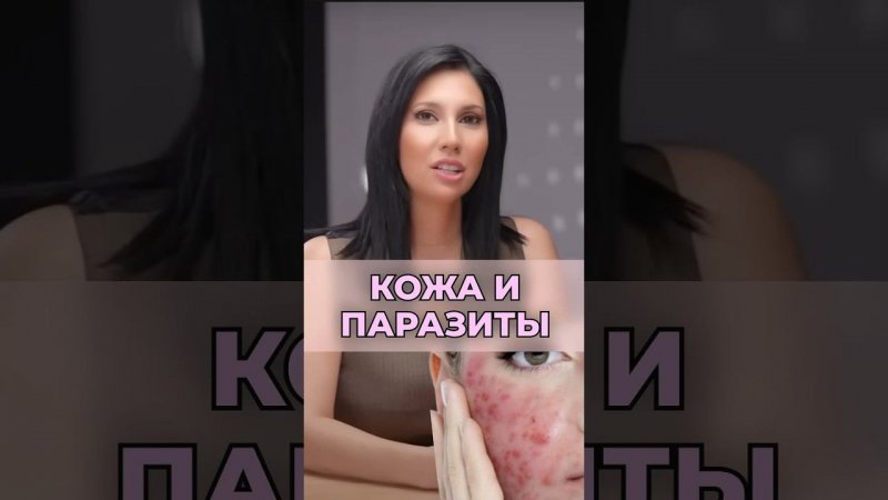 Как ПАРАЗИТЫ портят твою КОЖУ #акне #кожа #викторияорлинская