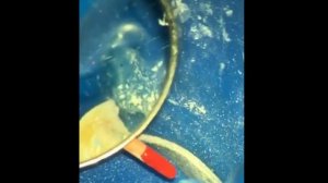 2020_7_27_Вялый голос заболевшего врача.