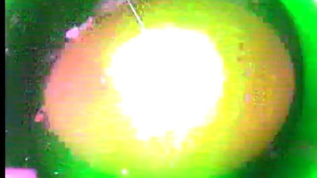 Разрушение скорлупы яйца лазером "Лазурит" смотреть онлайн