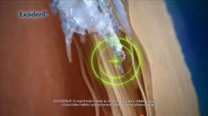 Exoderil kožní roztok proti plísním