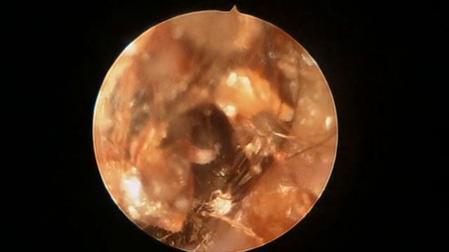 Отосокопия у собаки. Отодектоз, ушной клещ. смотреть онлайн