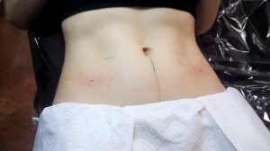 Microdermals by Leo Tolstoy | Установка микродермалов для Даши Говенко