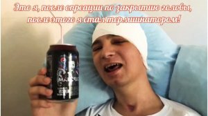 Трепанация черепа