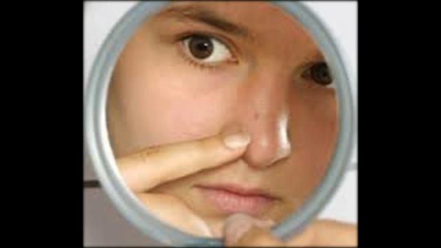 как избавиться от прыщей в зоне декольте смотреть онлайн