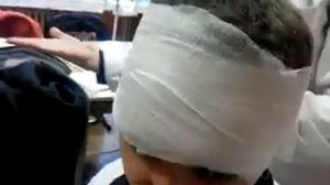 неаполитанская повязка на ухо