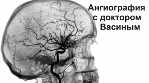 Ангиография с доктором Васиным