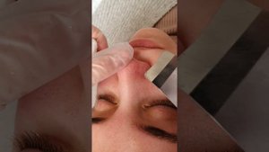 Уз-чистка лица. Когда нужно делать? И кому?