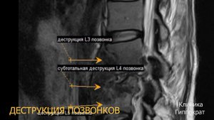 МРТ-диагностика от А до Я. МРТ головного мозга. МРТ позвоночника