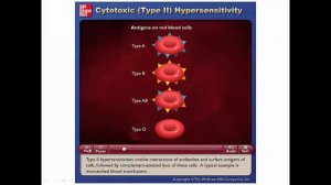 Unit 4. Chapter 16. Immune Disfunction