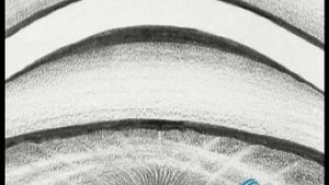 Компрессионная гониоскопия. Техника проведения