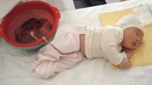 *Роддом*  Всё о чем молчат медики, и надо знать будущей роженице!!!