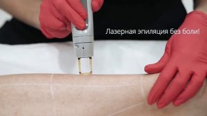 Лазерная эпиляция на аппарате Candela