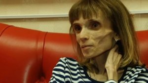Как изменилась участница «Пусть говорят» Кристина Корягина после программы