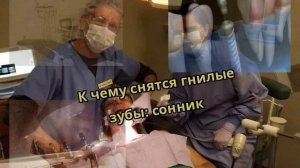 К чему снятся гнилые зубы: сонник