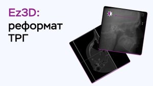 Возможности программы Ez3D: реформат ТРГ