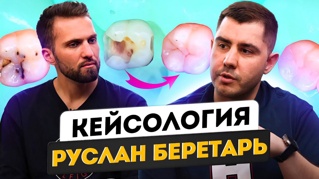 Руслан Беретарь - Восстановление нижнего первого моляра | Кейсология | Пафосный крендель