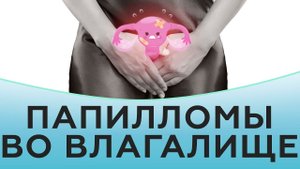 Папилломы во влагалище при венерических заболеваниях
