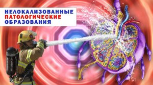 Лечение рака. Нелокализованные патологические образования. Практика по методу Арбузова