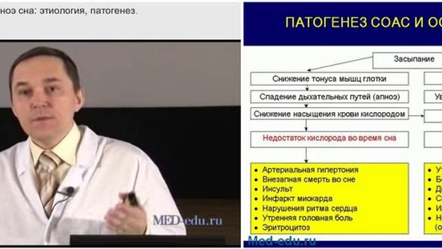 1_Синдром обструктивного апноэ сна: этиология и патогенез. Р.В. Бузунов