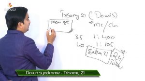 Trisomy 21 - Down's syndrome ( New )