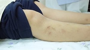 Точка здоровья и долголетия Цзу-сан-ли