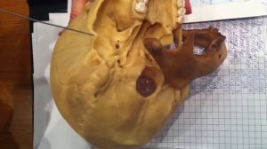 Соединение костей черепа - часть 1