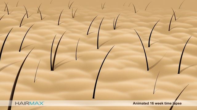 HairMax Laser Light Hair Growth Device Animation смотреть онлайн