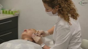 Биоармирование лица. Биоармирование жидкими нитями FIBROLIFT
